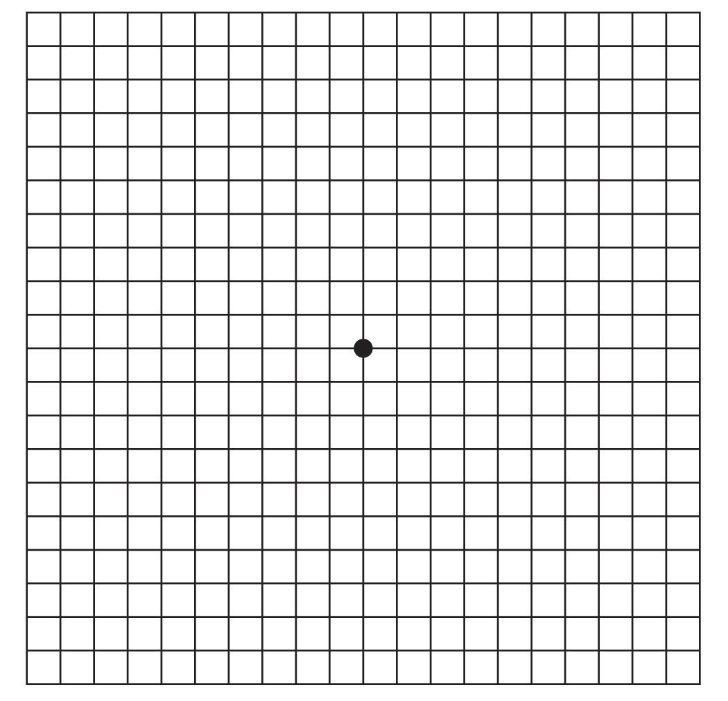 Amsler Grid